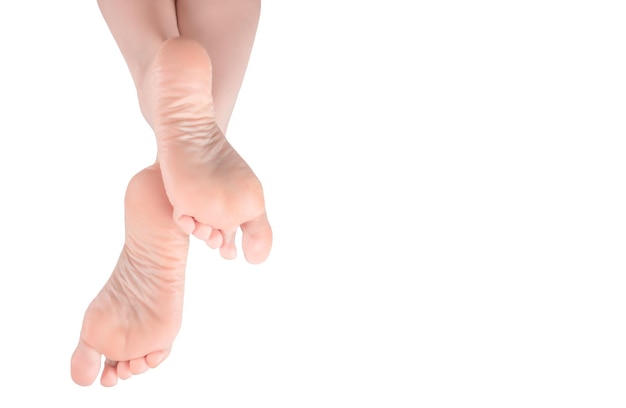 Female legs feet foot in an elegant position woman legs with rough and dry skin on heels of her feet after using moisturizer isolated on white background copy space