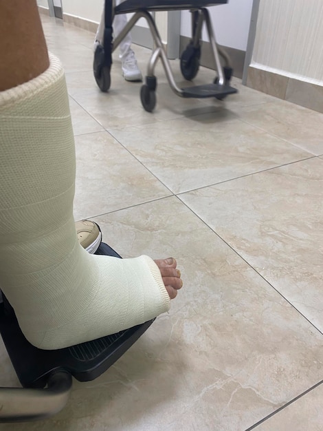 Female patient with broken leg