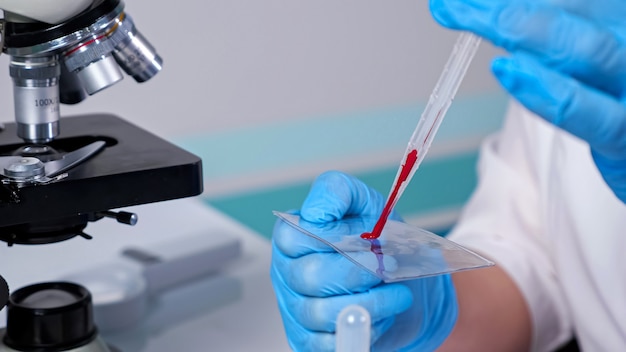 Female scientist in blue latex gloves drips red liquid on slide and puts on microphone at table in hospital laboratory extreme close view