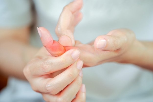 Finger pain woman due to various diseases related to bone Health care concept