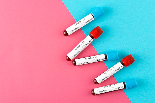 Flat lay coronavirus pcr tests arrangement