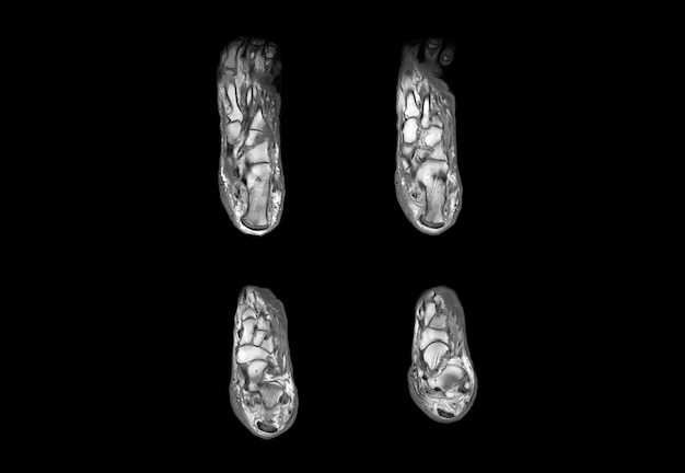 Foot MRI and ct scan xray image