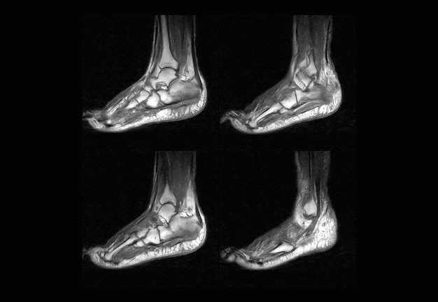 Foot MRI and ct scan xray image