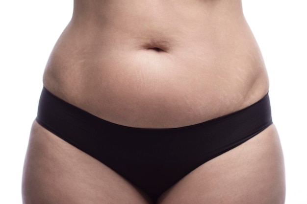 Fragment of a feminine figure with excess weight in black panties Stretch marks and belly fat Isolated on a white background Closeup Front view Health and beauty