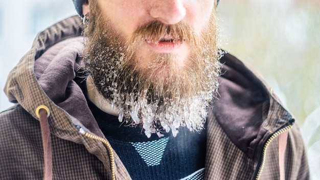 Frozen droplets on a beard