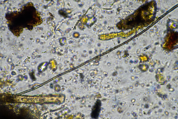 Photo fungal hyphae and soil fungi in a soil sample showing the living soil form a farm