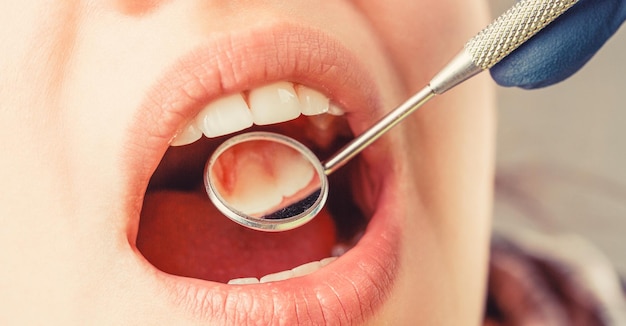 Girl having teeth examined at dentists Woman in stomatology clinic with dentist Healthy teeth concept