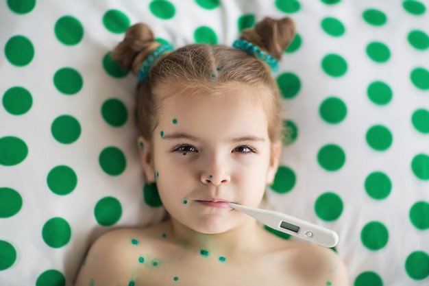 girl suffering from chicken pox measures temperature