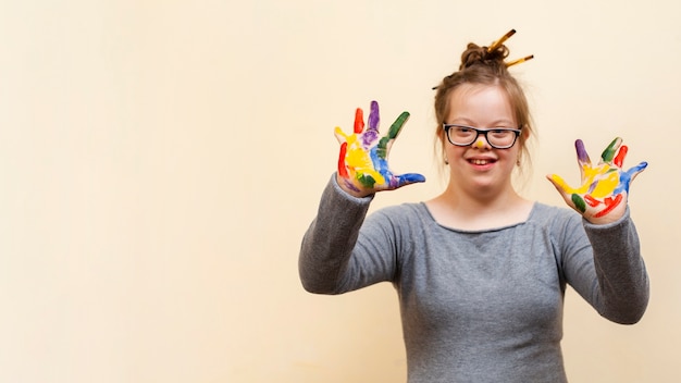 Girl with down syndrome showing off colorful palms