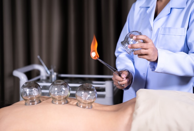 Glass cup with fire for cupping treatment on female back