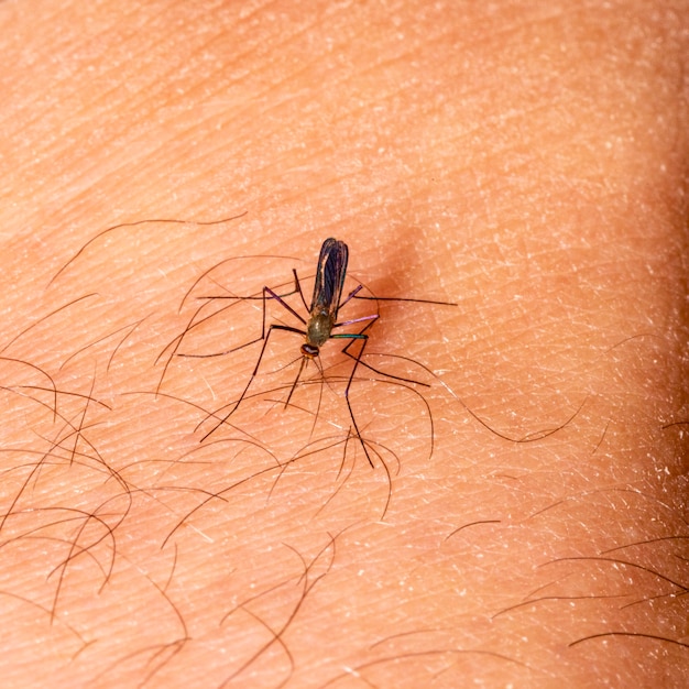 Gnat stinging human arm, plague.