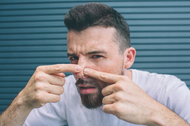 Guy is squeezing pimples on his nose. Isolated on striped