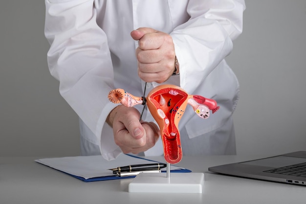 Gynecologist shows how to ligate the fallopian tubes on training model of female reproductive system