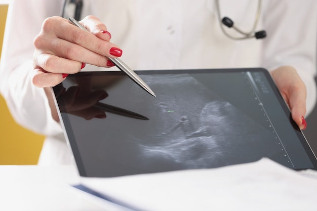 Gynecologist shows ultrasound of baby fetus on tablet gender determination concept