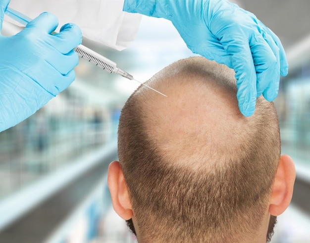 Hair losing man having an injection, hair treatment