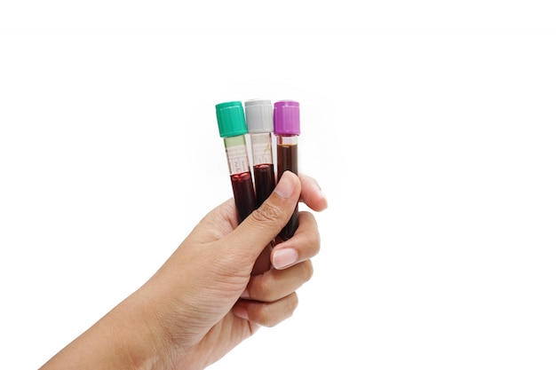 Hand of a doctor holding a bottle of blood sample