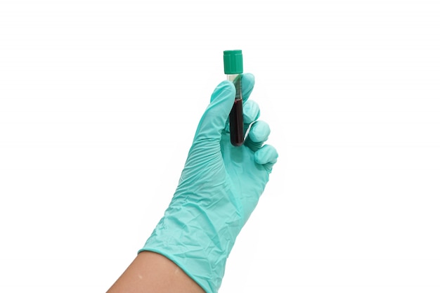 Hand of a doctor holding a bottle of blood sample