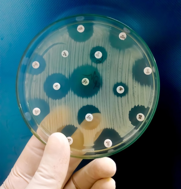 Hand holding Culture plate of bacterial growth showing antibiotic sensitivity in their colony