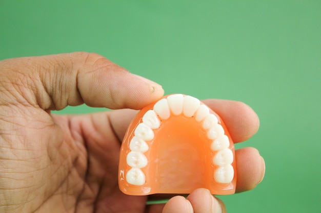 hand holding a model of the upper teeth