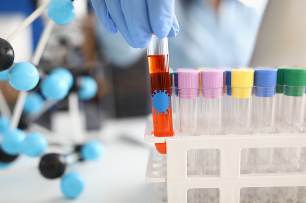 Hand holds test tube with liquid with coronavirus bacteria