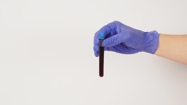 The hand is holding blood test tubes on white background Hand wears a purple medical glovex9