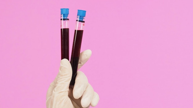 The hand is holding two blood test tubes on pink background Hand wears a white nitrile glove