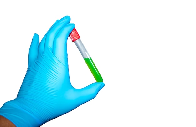 Hand with latex surgical glove holds sealed test tube with green liquid on white background.