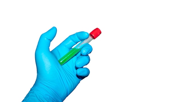 Hand with latex surgical glove holds sealed test tube with green liquid on white background.