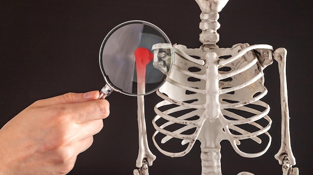 Hand with magnifying glass over humerus of human skeleton model Shoulder overuse strain overworked muscles ligaments Examination of painful arm with red spot