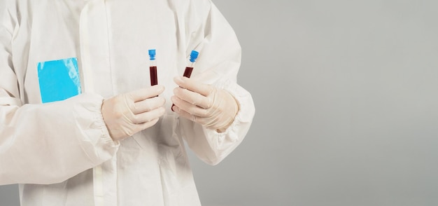 Hands are holding two blood test tubes on grey background. Hand wears a PPE suit and a white medical glove.