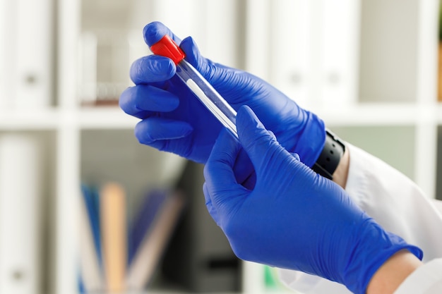 Hands of a doctor holding empty tube for blood test