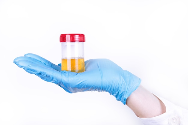 Photo hands of a doctor or nurse in blue gloves hold a container with a urine test