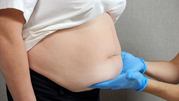 Hands of doctor in rubber gloves examine belly of patient