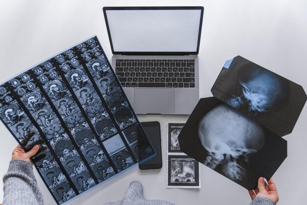 Hands hold mri results laptop on background with white screen