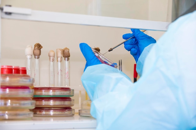 The hands of a physician laboratory assistant in an infectious disease laboratory