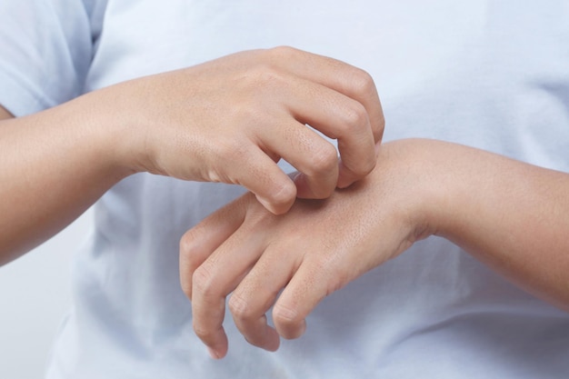 Health problems woman has itchy hands