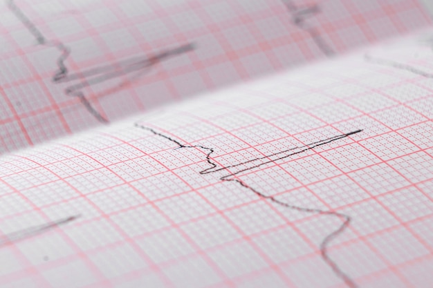 Heart electrocardiogram EKG chart on special paper. Concept for heart scan, health insurance, medical background, examination.