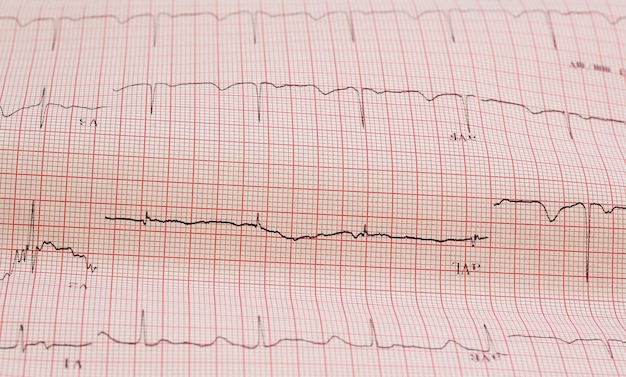 Photo heart rate paper