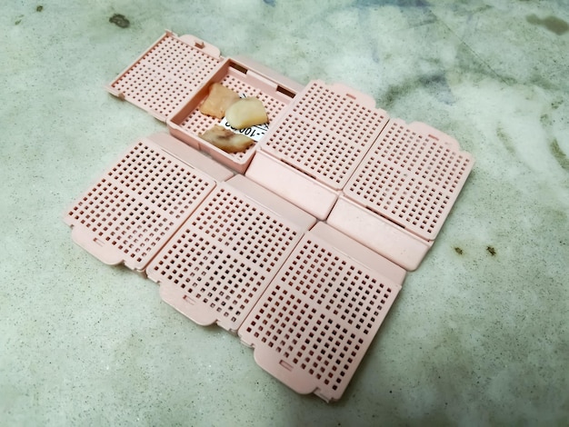 Histology tissue processing embedding cassettes during the specimen process in biopsy laboratory.