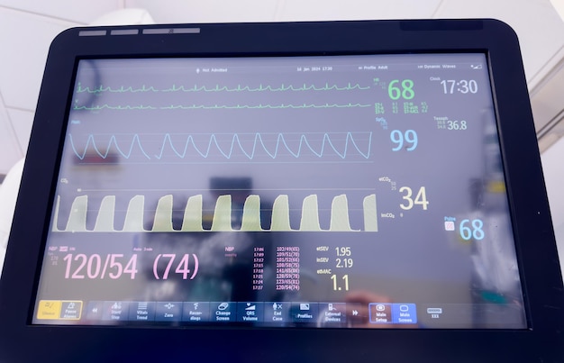 Photo hospital monitor displaying vital signs emphasizing healthcare technology and patient wellbeing