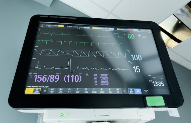 Photo hospital monitor displaying vital signs like heart rate blood pressure and oxygen levels symboliz