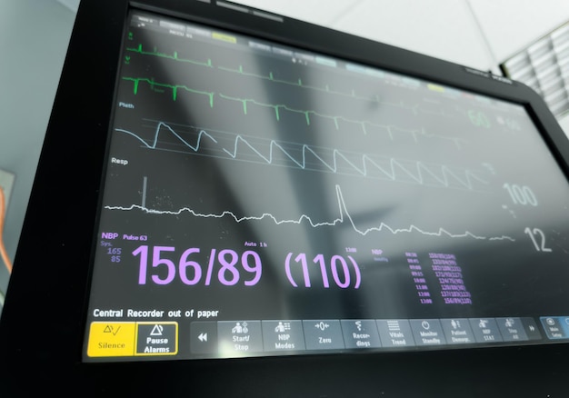 Photo hospital monitor displaying vital signs like heart rate blood pressure and oxygen levels symboliz