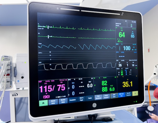 Photo hospital monitors display vital signs hemodynamics heart rate blood pressure temperature oxygen