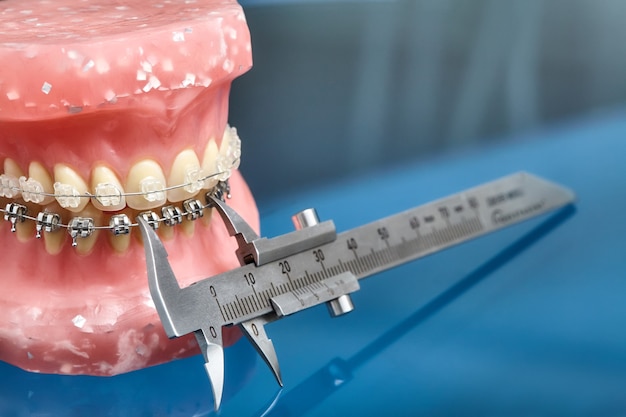 Human jaw or teeth model with metal wired dental braces and vernier caliper closeup