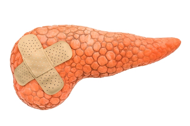 Photo human pancreas with adhesive bandages treatment of pancreatic concept 3d rendering