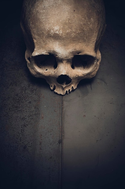 Human skull on metal