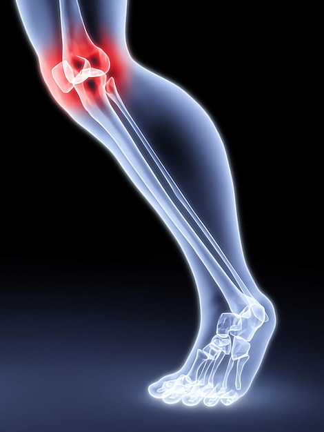 Illustration of knee joint pain in adult