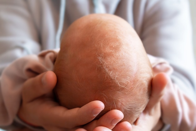 Infant baby girls asymmetric head close up