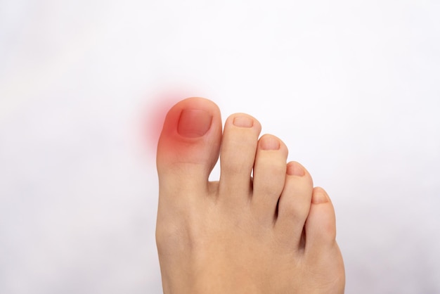 Inflammation on female foot with red spot concept of feet pain and disease