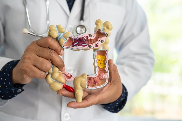 Photo intestine appendix and digestive system doctor holding anatomy model for study diagnosis and treatment in hospital